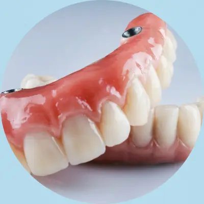 Fitting permanent dentures